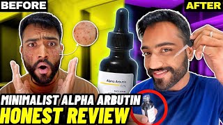 Best Serum For Dark Spots Minimalist ALPHA ARBUTIN Serum Review How to use Results Benefits [upl. by Stretch]