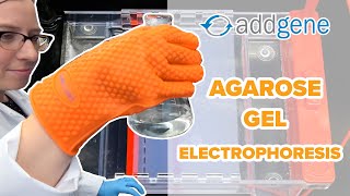 Agarose Gel Electrophoresis [upl. by Ashraf]