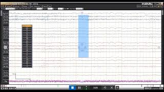 ARC Review Windows Behavior in Review  Arc 22 [upl. by Anzovin]