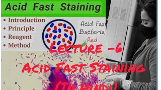 AFB Acid Fast Staining for MTuberculosis Bacillus staining medical viralvideoyoutube [upl. by Munafo]