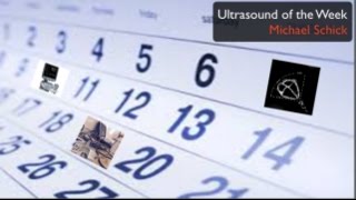 Ultrasound of the Week  Parotitis [upl. by Elletnohs]