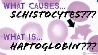 What causes Schistocytes What is Haptoglobin Hematology Hematopathology Basics [upl. by Okia]