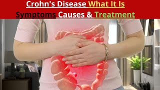 Crohns Disease What It Is Symptoms Causes amp Treatment [upl. by Lawrence]