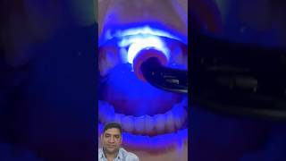 Amazing teeth transformation smiledentists miledentist trending viralshort [upl. by Cathleen]