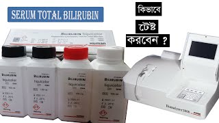 Total Bilirubin Test procedure ।। কিভাবে Total Bilirubin Test করবেন [upl. by Stafani]