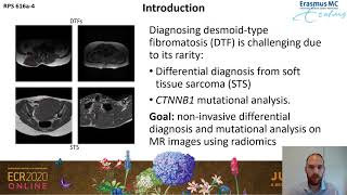 Distinguishing desmoidtype fibromatosis from soft tissue sarcoma on MRI using a radiomics approach [upl. by Henrie]