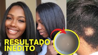 🚨 USE POR 2 DIAS PARA CRESCER CABELO IGUAL A CAPIM SENHORA DA ROÇA ENSINOU 😱🔥 [upl. by Ahsyekat]