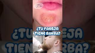 Cuida tu BARBA o causarás ESTO ✌🏻 más en IG medicina sabiasque curiosidades [upl. by Moriah237]