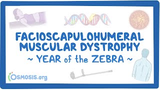 Facioscapulohumeral muscular dystrophy Year of the Zebra [upl. by Htabmas704]