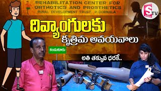 దివ్యాంగులకు కృత్రిమ అవయవాలు  Rehabilitation Center for Orthotics and Prosthetics sumantvkandukur [upl. by Orofselet]