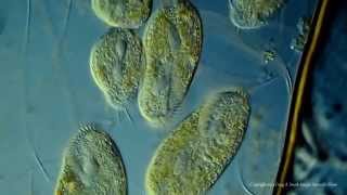 Various Ciliated Protozoa Kingdom Protista DIC Lighting Technique [upl. by Oisinoid]