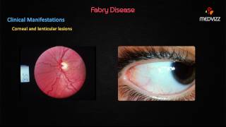 Fabrys disease [upl. by Nedac]