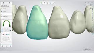 3Shape Clear Aligner Studio workflow with Bernhard Egger [upl. by Edd144]