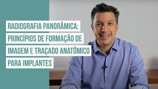 Radiografia Panorâmica Princípios de formação de imagem e Traçado anatômico para implantes [upl. by Lamoree]