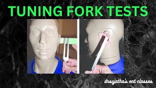 022 Tuning Fork Tests ear clinicalexamination [upl. by Liauqram]