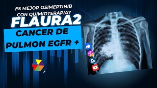 osimertinib innovacin en el tratamiento del nsclc [upl. by Lolande]