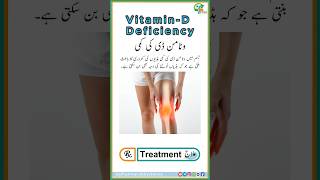 Vitamin D Deficiency symptoms and treatment in UrduHindi medicine shorts [upl. by Eirroc]