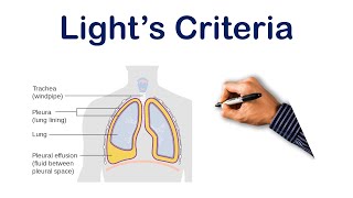 Pleural Effusion Lights Criteria  USMLE STEP COMLEX NCLEX [upl. by Nedia512]