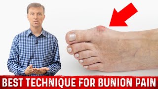 Bunion Pain Relief – The Simple amp Best Technique by DrBerg [upl. by Marin989]