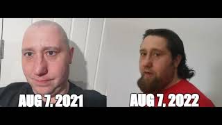 Hair Growth Time Lapse No haircut for 1 year Day by day selfie photos results [upl. by Rabkin]