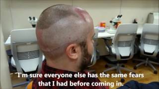 Patient IMMEDIATELY following an ARTAS robotic hair transplant talks about what it was like [upl. by Allayne]