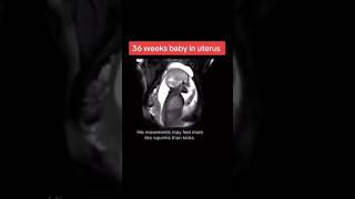 36 weeks baby in uterus pregnancy ultrasound🥰🥰🥰viralvideo trending baby [upl. by Greggory]