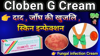 Cloben G Cream Uses in Hindi  Cloben cream use for Fungal infection  Skin disease Cream [upl. by Routh]