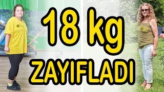 6 Yıl Bir Gram Zayıflayamadı HK Zayıflama Kampına Geldi 18 Kilo Zayıfladı [upl. by Marleah121]