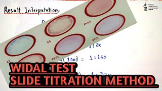 Widal test slide titrationdilution methodProcedure and result interpretation in an easy way [upl. by Sumedocin]