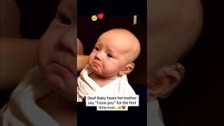 Deaf baby hears for the first time🥺♥️ shorts [upl. by Helbonnas214]