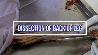 Dissection of Back of Leg [upl. by Hedveh]