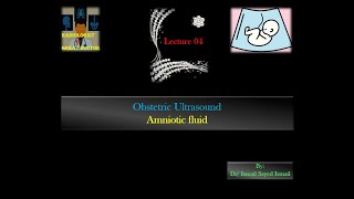 Obstetric Ultrasound Lecture 04 Amniotic fluid [upl. by Elora]