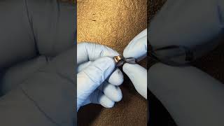 How to load a Tofflemire Matrix Band dentalassistanteducation dentalassisting [upl. by Carman]