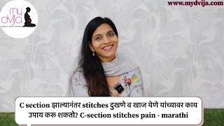 C section झाल्यानंतर stitches दुखणे व खाज येणे यांच्यावर काय उपाय  Csection stitches painmarathi [upl. by Ecarg509]