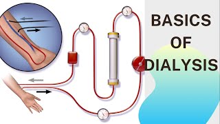 Basic concept of Dialysis Machine  Fresenius 4008S  Dialyzer amp Dialysate Function [upl. by Astraea68]