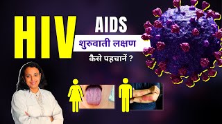 HIV Symptoms in Men amp Women  AIDS Aur HIV ke Lakshan Kya Hote Hai [upl. by Adai]