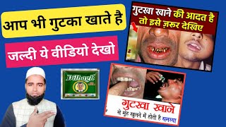 गुटखा खाने से बंद मुंह कैसे खोलें  OSMF Treatment  gutka khane se muh nahi khulta hai kya karen [upl. by Paderna]