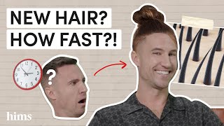 How Fast Does Minoxidil Work A Doctor Explains Minoxidil Results [upl. by Essyla]