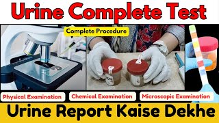 Urine Examination Test  Urine Test Report Kaise dekhe  Microscopic Examination of Urine urinary [upl. by Crain]