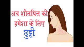 अब शीतपित्त की हमेशा के लिए छुट्टी II Urticaria Treatment  Dr Parmeshwar Arora [upl. by Cozza]