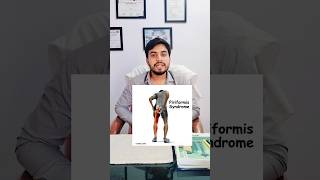 Piriformis Syndrome pain  Dr Akram  thai ka dardpiriformissyndromepiriformis painphysiotherapy [upl. by Enirak]