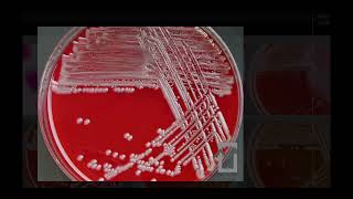 Achromobacter xylosoxidans  Microbiology [upl. by Hailahk]