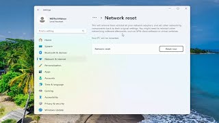 Network Connections Folder Is Empty in Windows 1110 Guide [upl. by Gervais708]