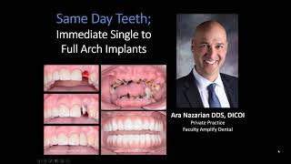 Webinar Full Arch Guided Dental Implant Techniques  Implant Education [upl. by Delorenzo521]