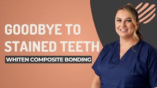 How to whiten composite bonding Can you use Teeth Whitening to whiten [upl. by Annoiek]