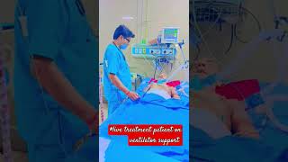 live treat patients on ventilator support ajeetsingh medical ki duniya short [upl. by Iolanthe]