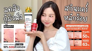 🔎 รีวิวสกินแคร์ลดสิว ตัวช่วยกอบกู้ผิวในราคาหลักร้อย Clinical test DC  Clinical test AA  Babyjingko [upl. by Dich]