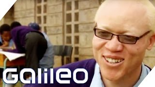 Albinos in Afrika  Galileo  ProSieben [upl. by Berthe]