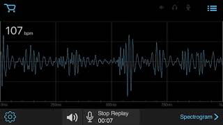 EStethescope amp Auscultation App  s3 gallop [upl. by Aruon]