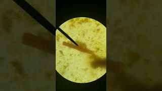 Microbiology Strongyloides stercoralis [upl. by Anilek]